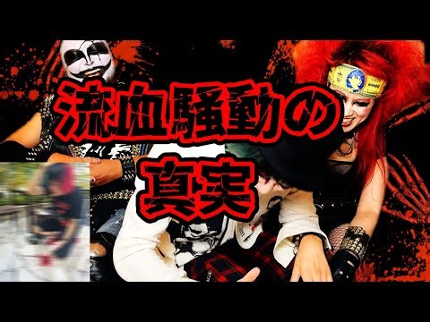 This is the story of the legendary head splitting incident that required 11 stitches.