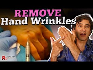 HAND FILLER // How to Remove Hand Wrinkles