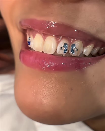 #toothgems #tooth #gems #zirconia #crystal #gemstonejewelry