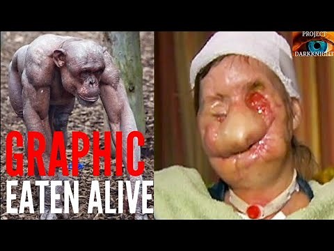 Eaten Alive By Chimpanzee: Womans Face Ripped Off By Travis The Chimp & 911 Audio