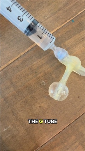 Here is my tutorial on how to change a g-tube! Every 3 months my daughter needs hers changed!#gtube