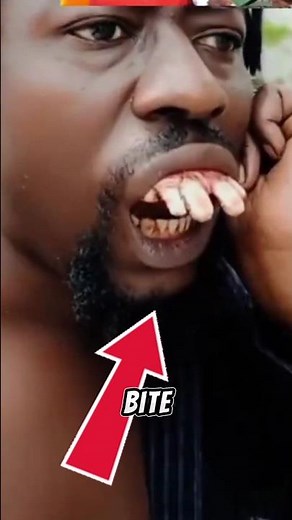 Longest Teeth |Born Different