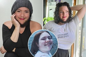 I’m a ‘bearded lady’ — after fighting it for years, I now love all of me