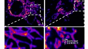 A PATHOLOGIST SUMMARY OF WHAT THESE JABS DO TO THE BRAIN AND OTHER ORGANS