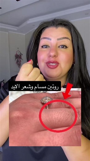 روتين مسام الايد وشعر عقل الاصابع 💅#fyp #مسامات_واسعة #الاصابع #handhair #مسامات_واسعة