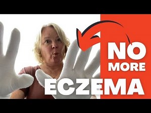 Comfort Meets Care: Cotton Gloves for Eczema and Dry Hands!