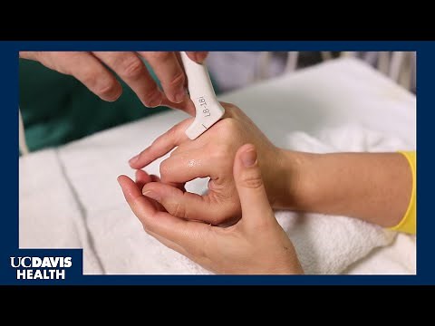 Why Do Knuckles Crack? - A UC Davis Health Study