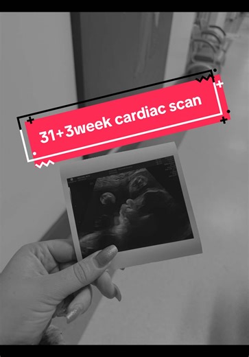 31 Weeks Pregnant: Cardiac Scan Update and Insights