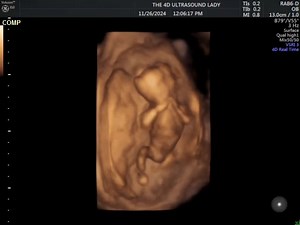 14 weeks old, 3 ounces, full of life 😍 | The 4D Ultrasound Lady
