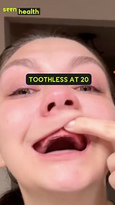 867K views · 5.7K reactions | All My Teeth Were Pulled Out At 20 ‘I am a toothless babe.’ Cheyenne started noticing spots and decay on her teeth after her braces were removed. At 20, her dentist recommended dentures. She shares her struggles with dentures and how she's learnt to overcome them. | seen.tv | Facebook