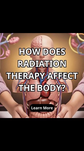 Learn general information about how radiation therapy works and the factors involved in treatment | Smart Choice Hub