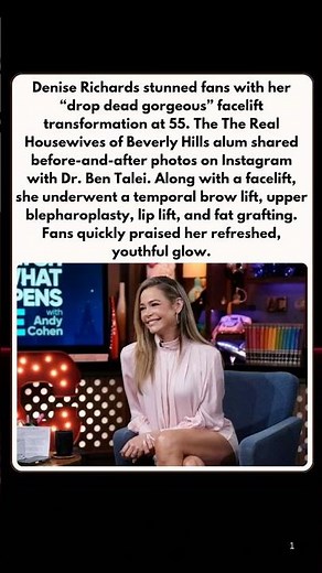 Denise Richards’ Stunning Facelift Transformation Revealed at 55 😱✨
