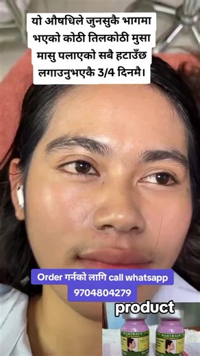 Effective Mouse Removal Solutions for Homes in Nepal