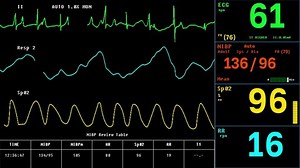Electronic Health Monitor Machine Checks Vital Signs Of Ill Patient. Electronic Machine Detects Decline In Vital Signs Of Patients Heart. Electronic Machine Monitors Vital Signs Of Patient. ECG