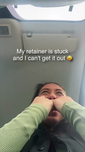 Retainer stuck? 😳 Try this… #retainer #braces #stitch with @Liv 👼 #orthodontist