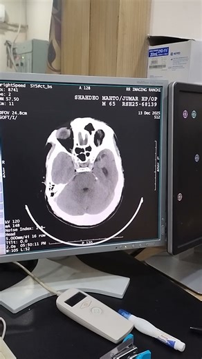 ct brain live #youtubeshorts #shortfeed #doctor #science #shortvideo #anatomy #medicalimaging