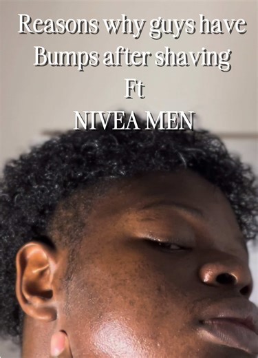 Effective Beard Care Tips to Prevent Bumps