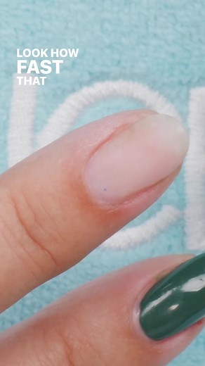 Acetone as a nail polish remover is the quickest and most effective way to remove polish. Although it will temporarily dry out the skin around the nail bed, this can be easily fixed with adding a little oil afterward ✨ #nailcareereducation #nails #nailpolish #nailtech #nailtechlife #diynails #nails💅 #nailtok #nailsoftiktok #nailtutorial #nailtechcheck #nailartist
