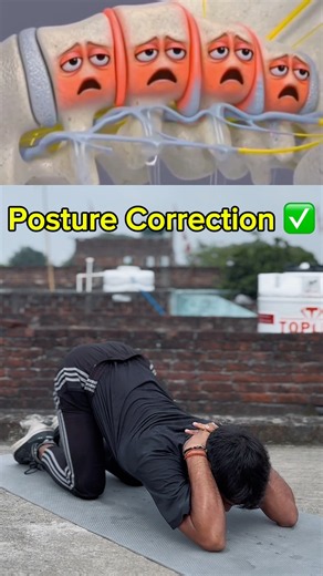 ✅ Rounded Shoulders & Hunchback? Try These Easy Exercises! #shorts #hunchback #posture #stretch