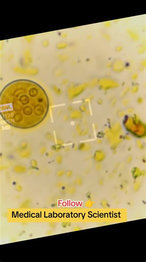 Understanding Stool Examination for Parasitic Identification