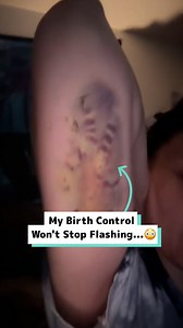 467K views · 367 reactions | Help, my birth control implant is flashing inside my arm! 勞 | Craft Factory | Facebook
