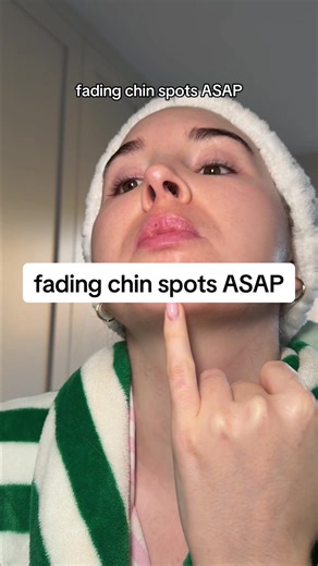 Quickly Fade Hormonal Acne Spots: Essential Skincare Routine