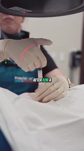 A blood patch is a medical technique where a small amount of a patient's own blood is injected into the epidural space of the spine. This procedure is most commonly used to treat spinal headaches, which can occur after a spinal tap or spinal anesthesia. By injecting blood, the procedure helps to form a clot, sealing any leaks in the cerebrospinal fluid and alleviating pain. The process is typically quick and can provide immediate relief #bloodpatch #painmanagement #backpain #doctor
