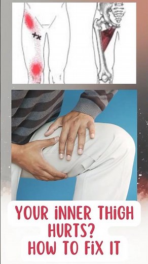 Inner thigh pain when moving, walking, or sitting? How to fix it