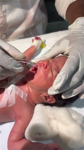 putting ogtu on newborn baby😭😭 #youtubeshorts #nursing #medical #newbornbaby #cutebaby #childbirth