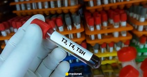 Anty-TPO wysokie, a TSH w normie - co to oznacza?