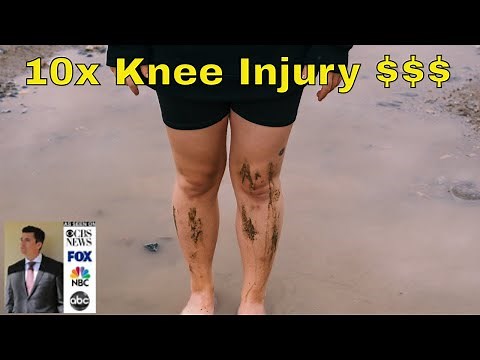 How To Maximize "10x" Your Personal Injury Settlement for Knee Injury: Meniscus, ACL, ...