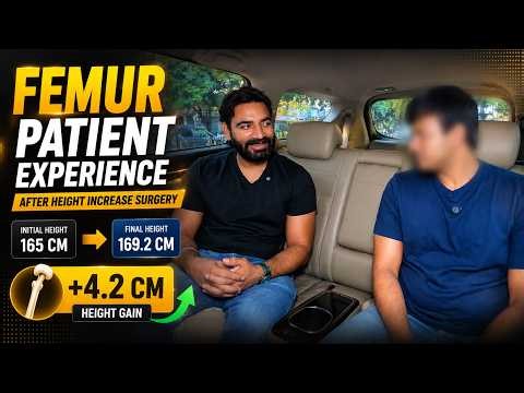 165 CM to 169.2 CM | Real Femur Lengthening Patient Experience (+4.2 CM)