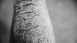 Psoriatic Arthritis Rash: Pictures, Symptoms, and Treatment - GoodRx