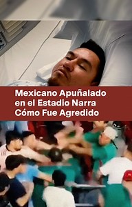 Emmanuel Díaz Leal, el joven mexicano que fue apuñalado en la tribuna, durante un juego de la Selección Mexicana se recupera en un hospital de San José, California, donde compartió la experiencia que vivió esa noche. El pasado domingo Emmanuel y sus amigos asistieron al Levi’s Stadium de Santa Clara, California, para ver el juego de México ante Qatar en la Copa Oro. | NMás