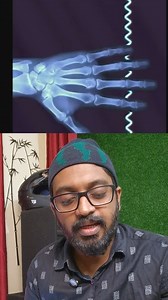 How CT scan works..? #medical #ct #xray #how #information | Jino Kiran VS