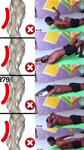 🌱How To Fix Bad Posture "Tech Neck"