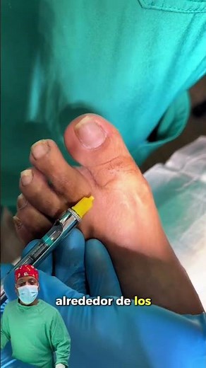 Toe Block Anesthesia | Step-by-Step Technique 💉👣