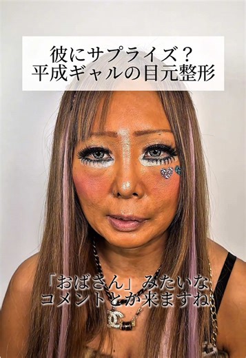 平成ギャルの目元整形サプライズ