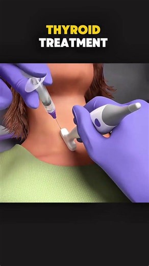 Thyroid Problems & Their Treatment 🩺 #Shorts #medical #paramedical #dmlt