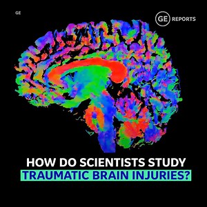 Our Signa Premier MRI machine is giving researchers a better view of brain injuries. http://invent.ge/2FeSM89 | GE