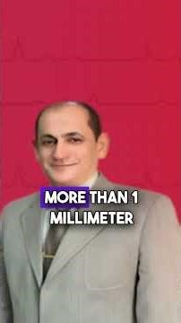 criteria b concordant st depression insights