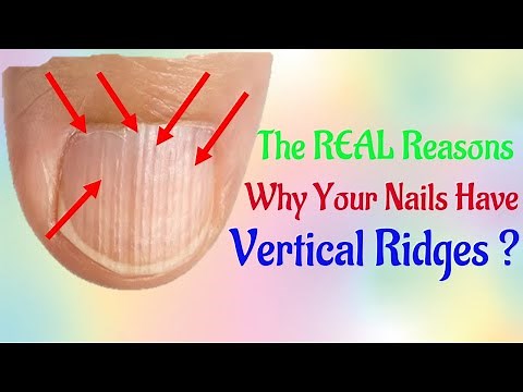 The REAL Reasons Why Your Nails Have Vertical How to Treat and Fix Vertical Ridges