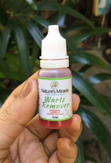 Effective Kasoy Oil for Warts and Skin Tag Removal