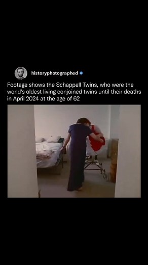 Lori and George Schappell, the world’s oldest living conjoined twins, passed away in April 2024 at the age of 62. Born in 1961 in Pennsylvania, they were joined at the head, sharing some brain tissue and blood vessels. Despite medical predictions that they wouldn’t live beyond 30, they led remarkable lives. George, born as Dori, came out as a transgender man in 2007, making them the first conjoined twins with different gender identities. Lori was a bowler, while George enjoyed a career as a coun