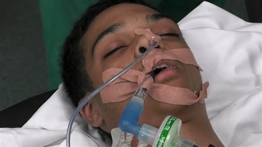 急诊室的故事｜Emergency Defibrillator Saves Footballer’s Life