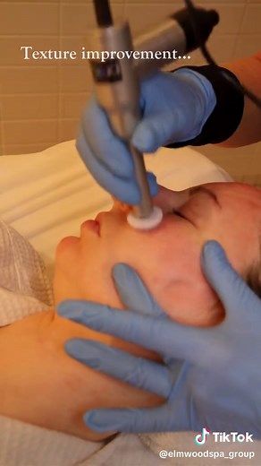 Ready to take your skin to the next level? Try Microneedling at elmspa! How it works? Bringing skincare and technological innovation together, the 50-minute microneedling treatment uses a hand-held device to create a pattern of small micro channels or microscopic “wounds” that result in smooth and even skin. Microneedling at elmspa: \t•\t$275 per treatment. Only sold in a series of 3 or 6 sessions. \t•\t3 treatments: $825 and 6 treatments: $1,485 (10% OFF) Benefits of a 50-minute Microneedling t