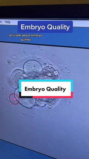 We can look under the microscope and see where embryos are supposed to be my days 5-7. We like to get them to a blastocyst stage, which is a hollow ball with an inner cell mass that becomes the baby. These embryos have a very good chance of going on to make a baby.##ivf##baby##pregnancy##embryo##ttc##pgt
