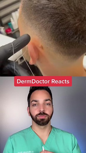 Home Mole Removal Dangers: DermDoctor Reacts