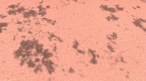 Skin Detoxification Melanin Stock Footage Video (100% Royalty-free) 10329941 | Shutterstock