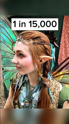 The Rarest Human Genetics 🤯